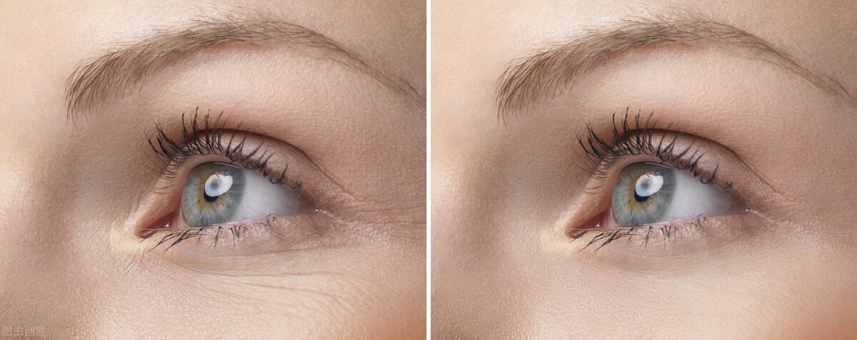 预防眼周皱纹最好方法,减少眼周皱纹的最佳方法