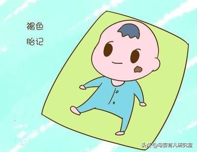 宝宝身上的青胎记能消么,宝宝身上有很多胎记淤青是为什么