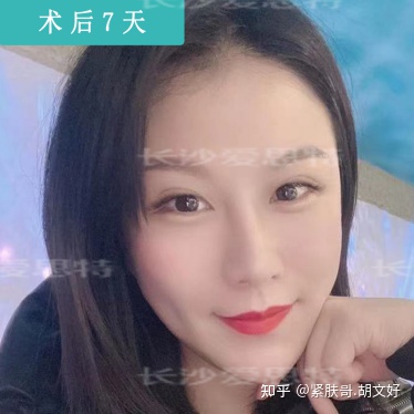 哪些人群不适合做热玛吉?