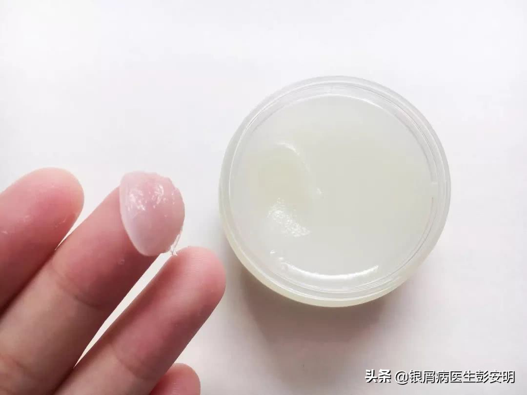 凡士林加西瓜能治好银屑病吗,银屑病西瓜霜和凡士林