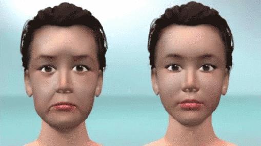 干货分享你真的了解玻尿酸吗,关于玻尿酸这些知识要知道