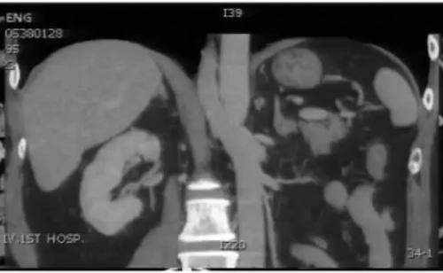 腹部ct详细讲解,腹部ct示意图及超详细教学