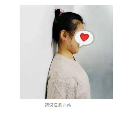 颈椎不稳定造成的头晕和颈肩痛，我们该如何缓解？