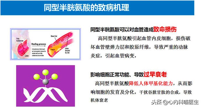 同型半胱氨酸型高血压吃多久叶酸,高血压同型半胱氨酸多高要吃叶酸