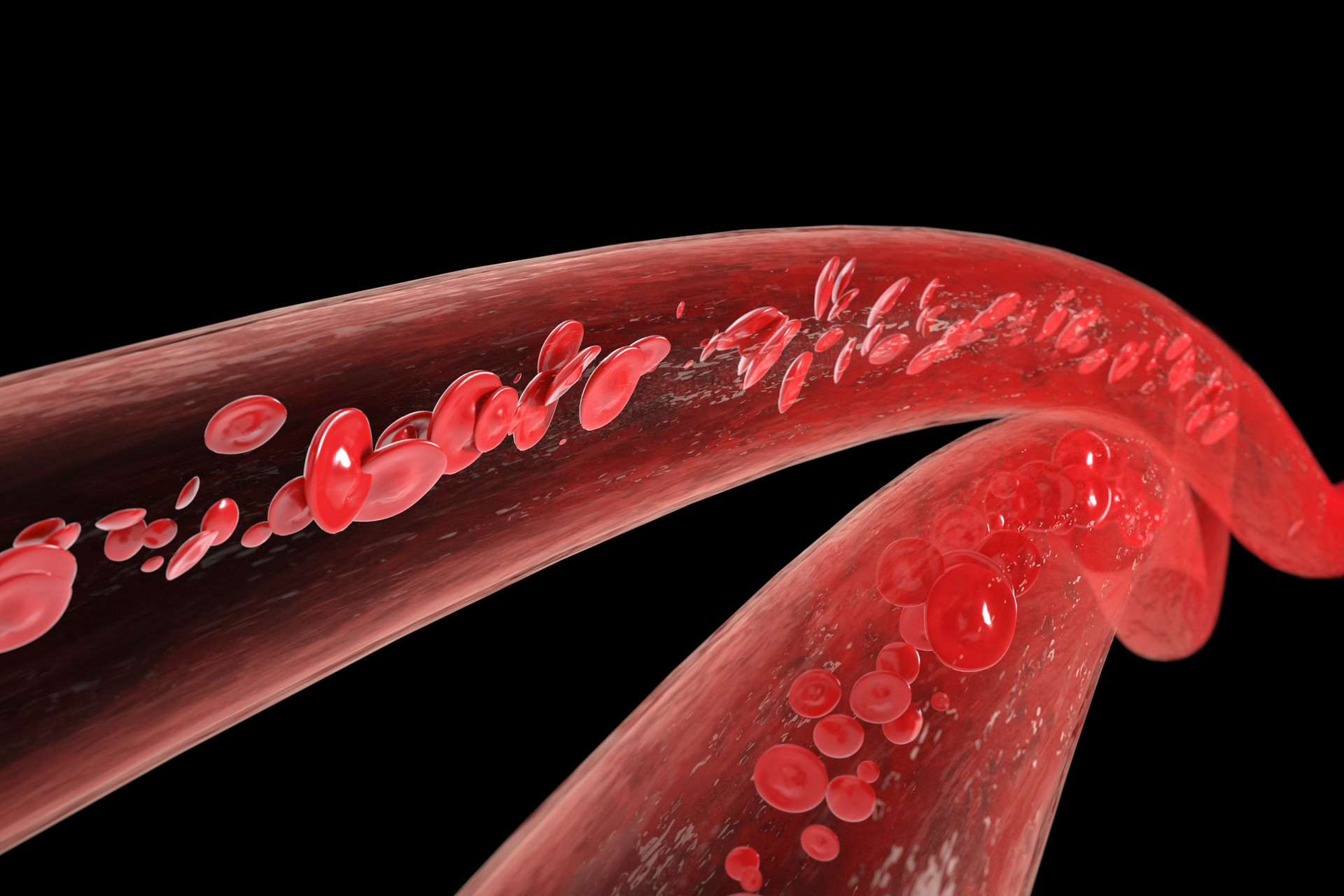 麦迪森健康：身上不痛不痒却总是莫名淤青？这些情况要注意