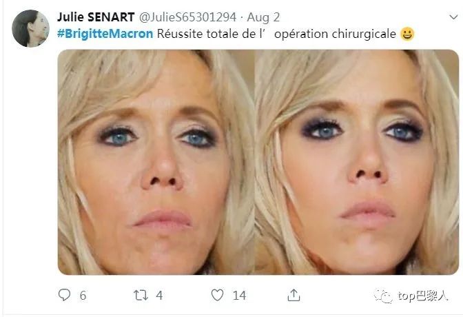 法国情侣豪掷200万,经历15次手术,只为成芭比与肯尼