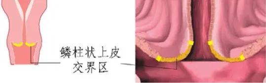 关于宫颈的那些谣言，你信过几个？——优秀科普作品展播