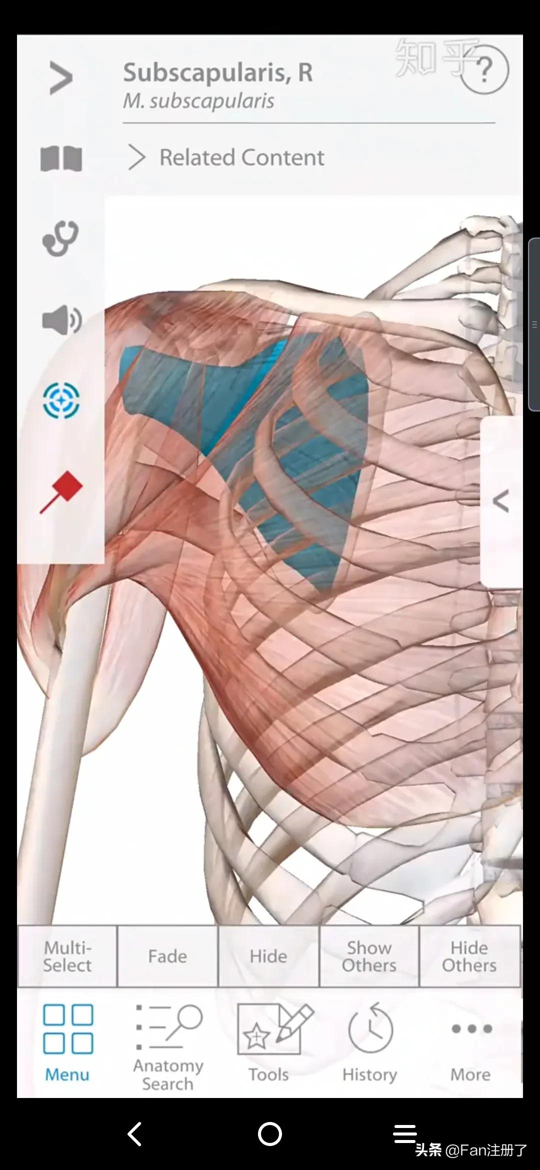 肩痛肩袖损伤针刀治疗,肩痛肩关节活动受限用什么药