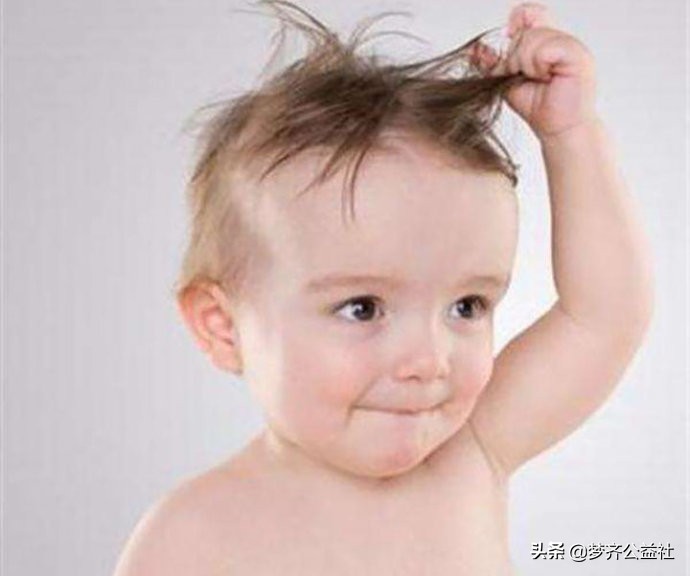 4个月小孩头发稀少什么原因,婴儿头发稀少的原因及解决方法