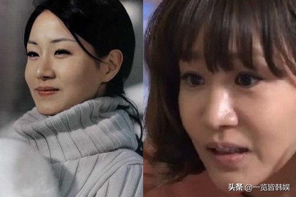 47岁申恩庆图片,47岁申恩庆削骨现状