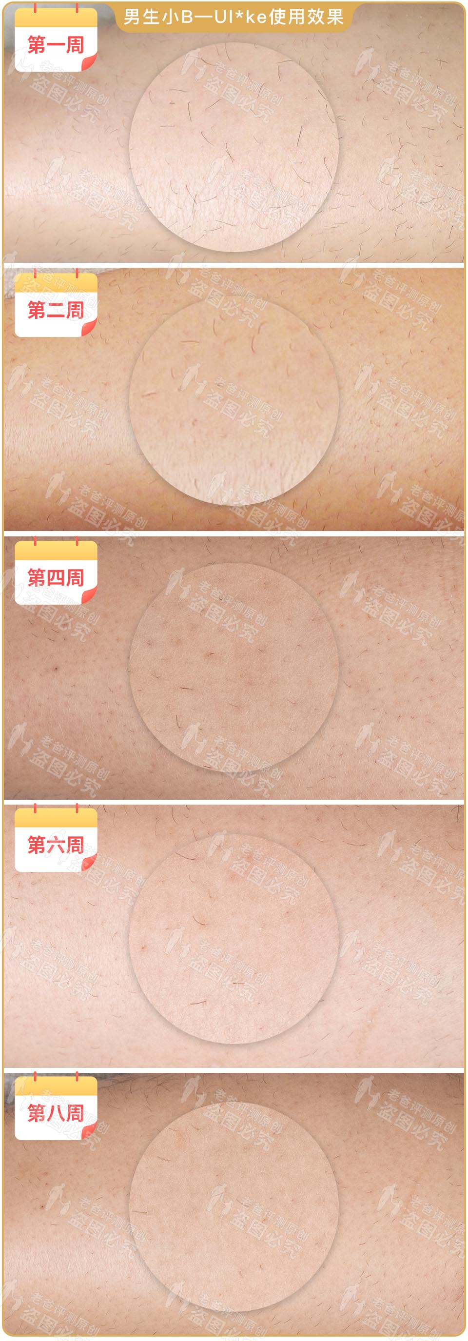 最真实的脱毛仪,bequeen脱毛仪实测