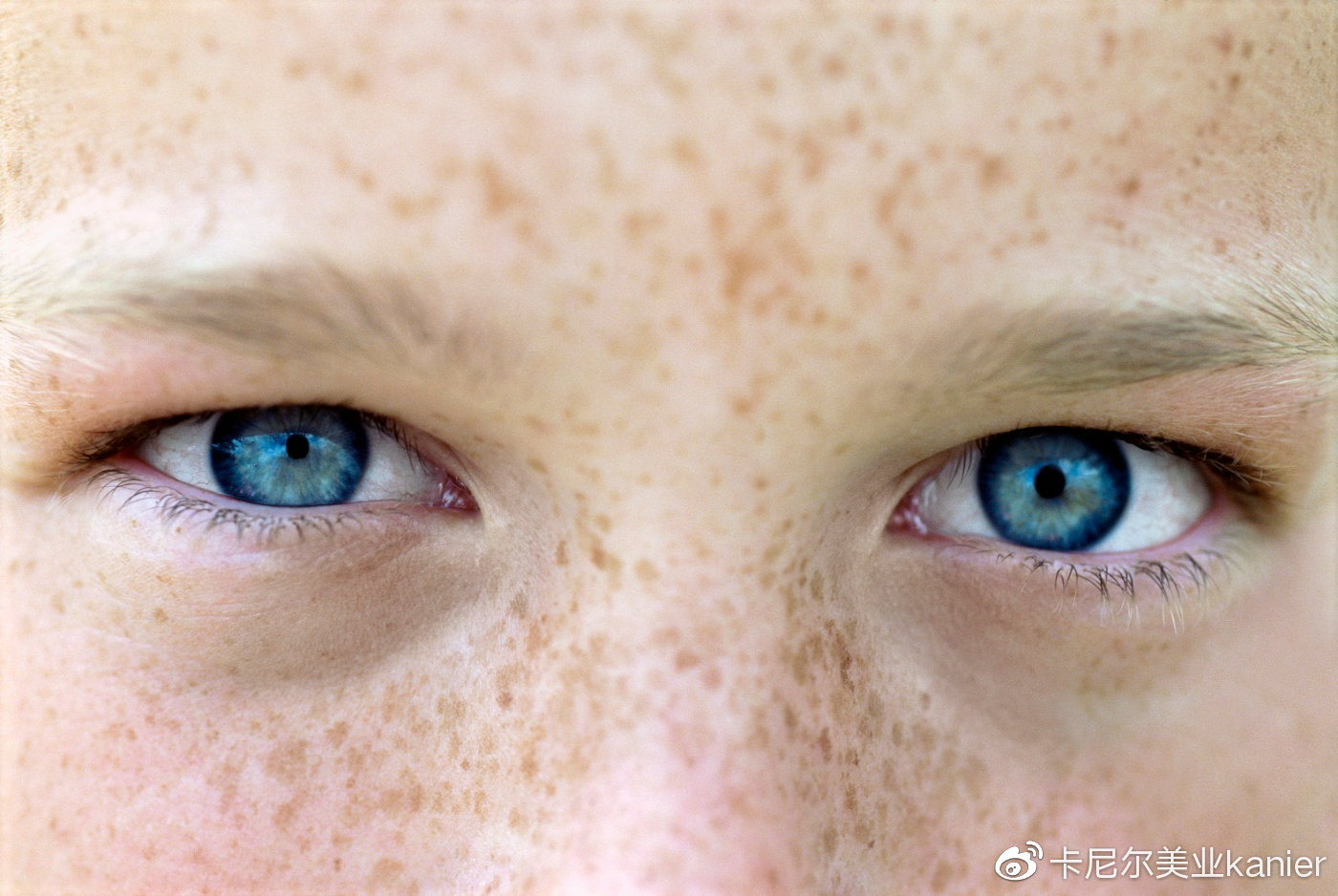 很多痘印如何正确遮瑕,暗黑色痘印用什么医美