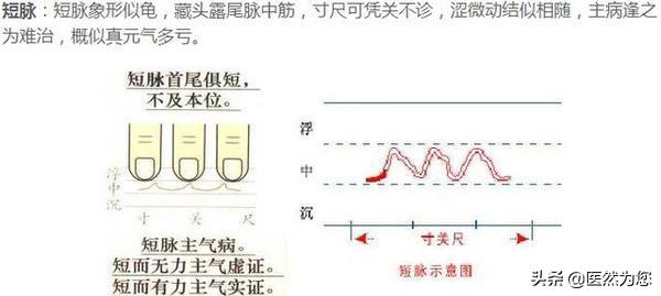 脉象动态图,脉象动图