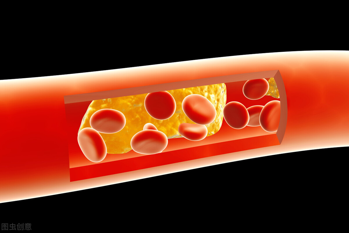 睡觉手脚麻是什么问题,睡觉时手脚发麻是什么意思