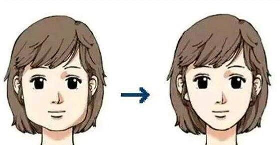 瘦脸针危害和副作用是什么,瘦脸针有什么危害和副作用