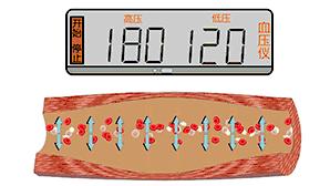 血管堵塞动态图片,血管疏通动图