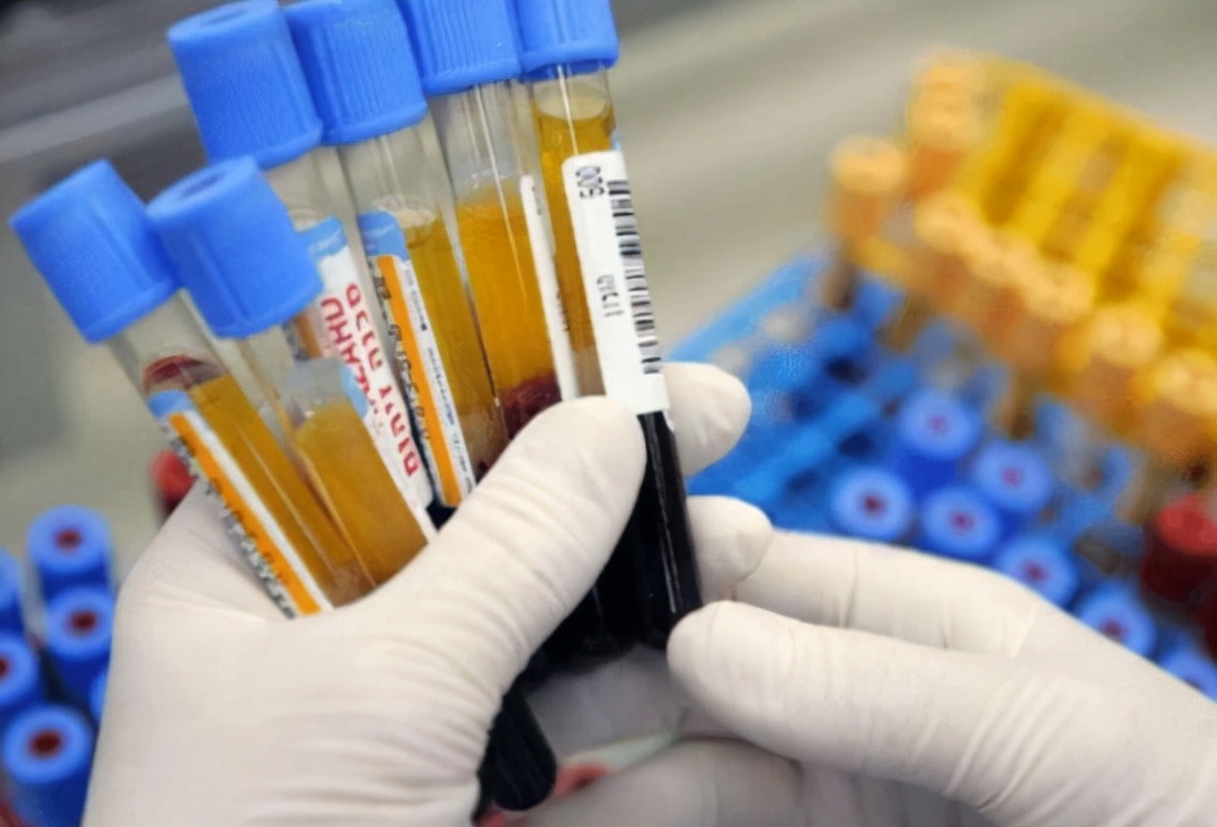 血常规检查三项偏高,血常规检查3项高有什么病