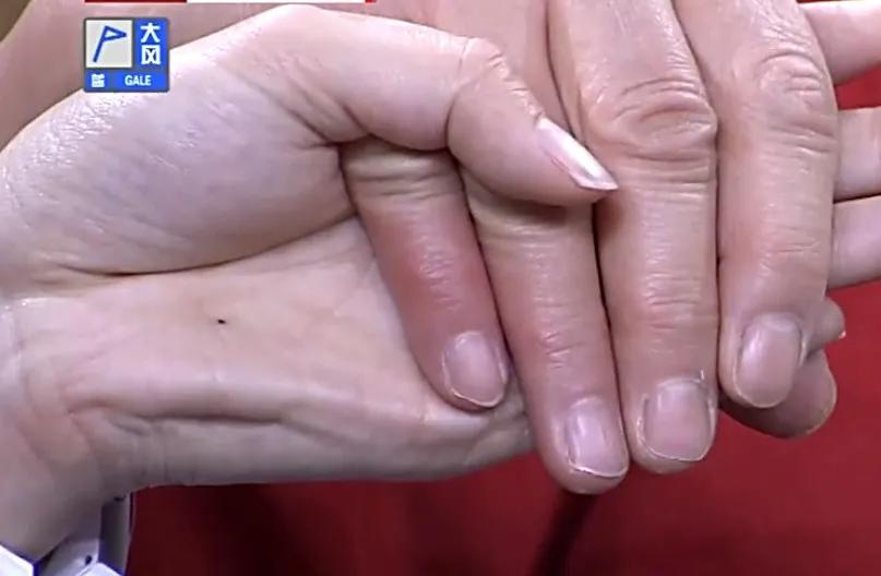 身体好不好,看手就知道!这几处变化可能藏大病