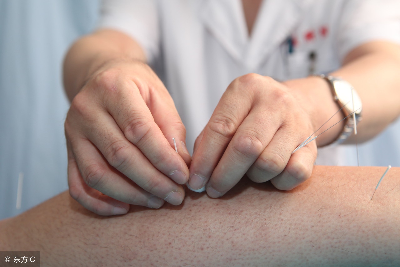 学习针灸之针灸一夜通