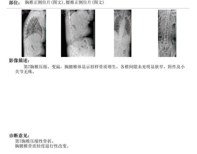50多辆车高速路接连爆胎,近20万买的新车半年内两次失控