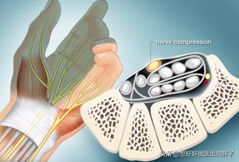 一跑步手就肿怎么回事,走路跑步身体发痒什么原因