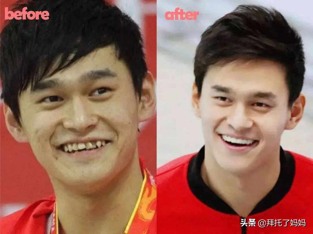 孩子有这三个习惯会越来越丑,越长越丑的几个习惯