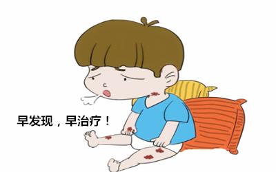 鲜红斑痣会出现血管瘤吗,鲜红斑痣是皮肤血管瘤吗