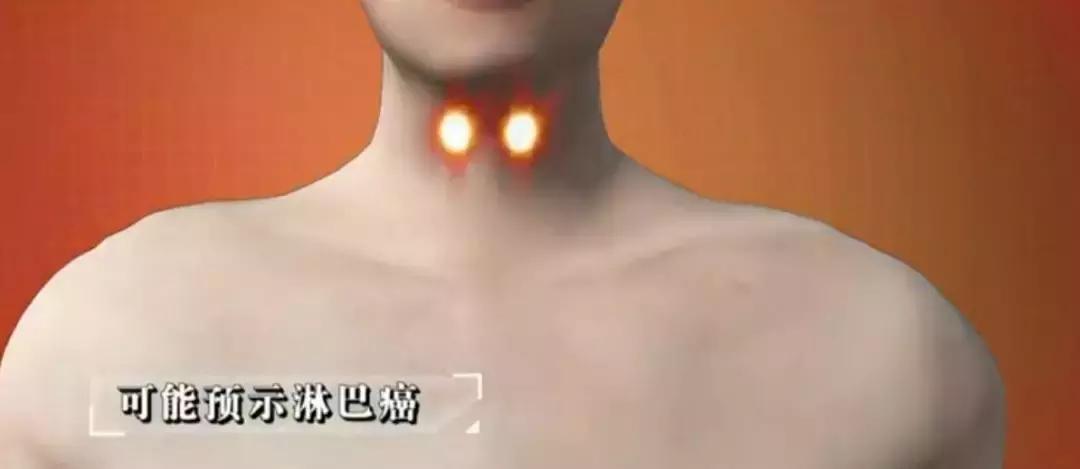 危险三角区会有什么症状,面部危险三角区有哪些危害