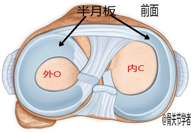 磁共振检查半月板损伤有误诊率吗,半月板磁共振会不会有误诊
