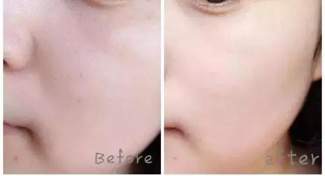 年轻人的抗老精华,用了惊艳的抗老精华