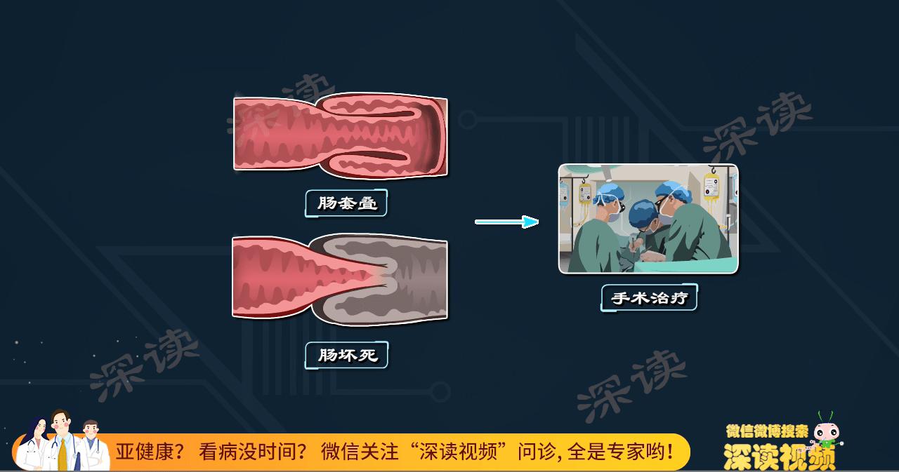 过敏性紫癜反复难根治？激素治疗靠谱吗？动漫科普紫癜治疗黑科技