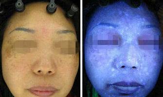 荧光面膜绿灯侠,荧光剂面膜会荧光一辈子吗