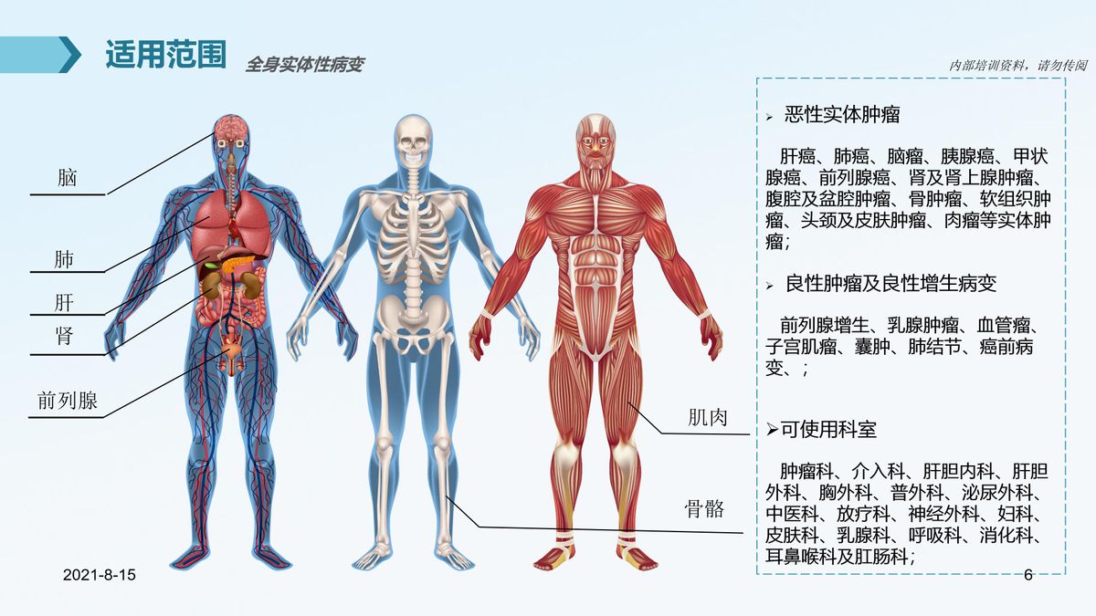 氩氦刀治疗肿瘤的医院,氩氦刀治疗肿瘤范围多大
