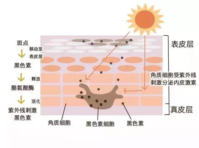 咖啡因淡化什么类型黑眼圈,黑眼圈三种类型你属于哪种