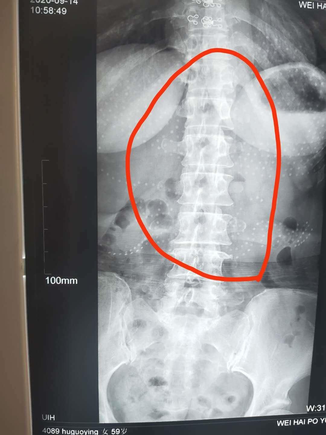 你还在受困扰吗,你是否还在被腰疼困扰