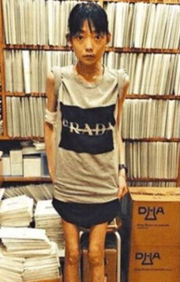 嫁给一个富裕家庭8年后他瘦到了44磅武志恒被赶出家门经历了什么