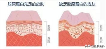 胶原即食鱼胶,鱼胶真的能补充胶原蛋白吧