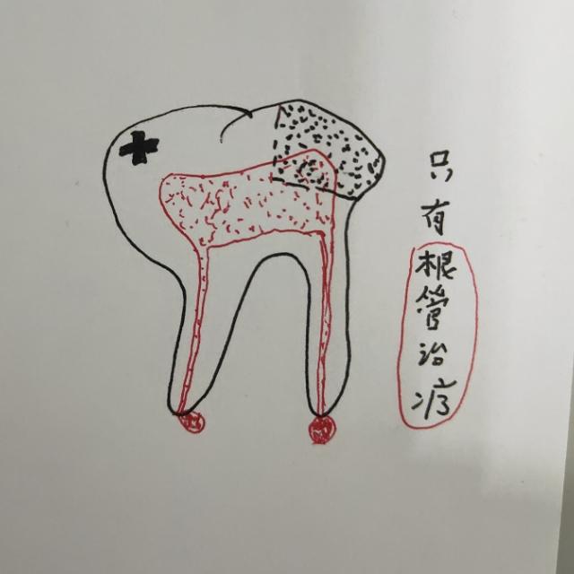 口腔牙齿出了问题怎么办,牙医说牙齿有洞怎么处理