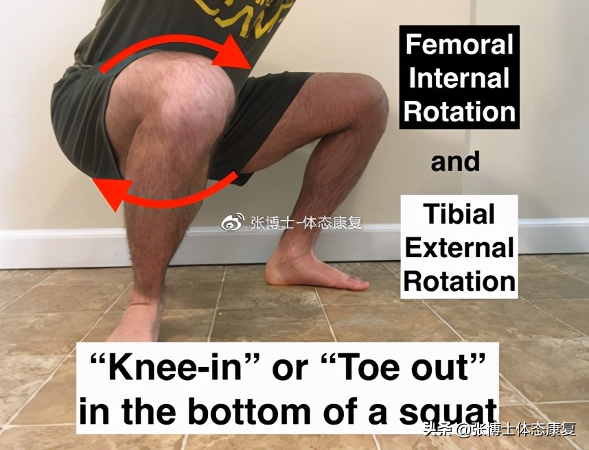 运动康复膝关节疼痛解决,下髌骨关节疼痛综合征