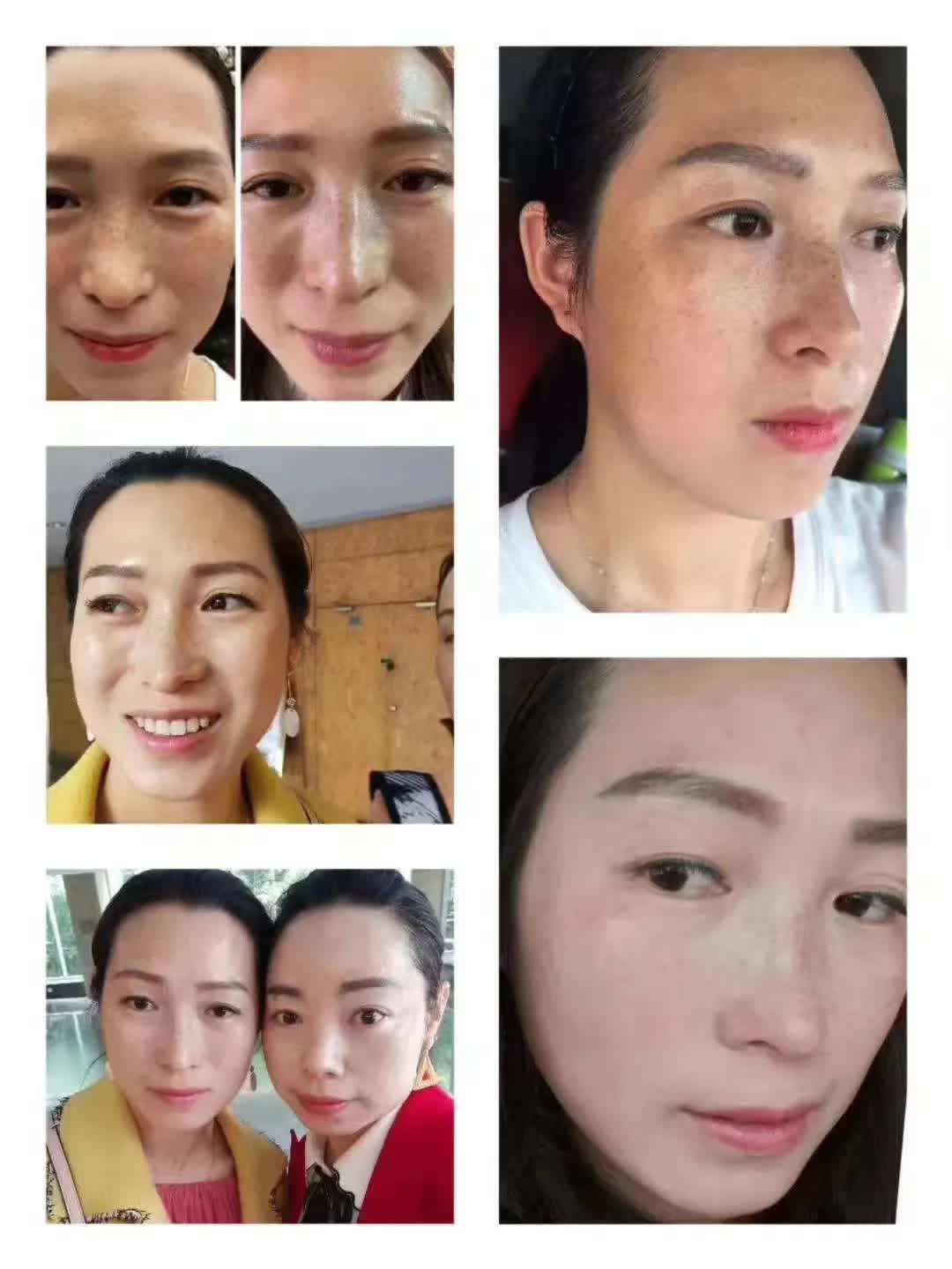 推荐好用的祛斑套盒,祛斑套盒推荐测评