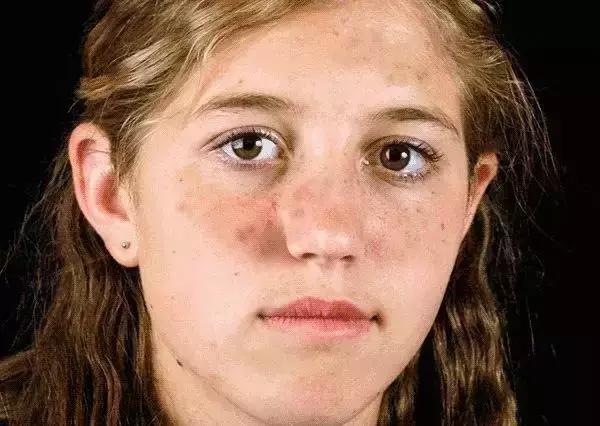 日本的美白针,日本最强美白针