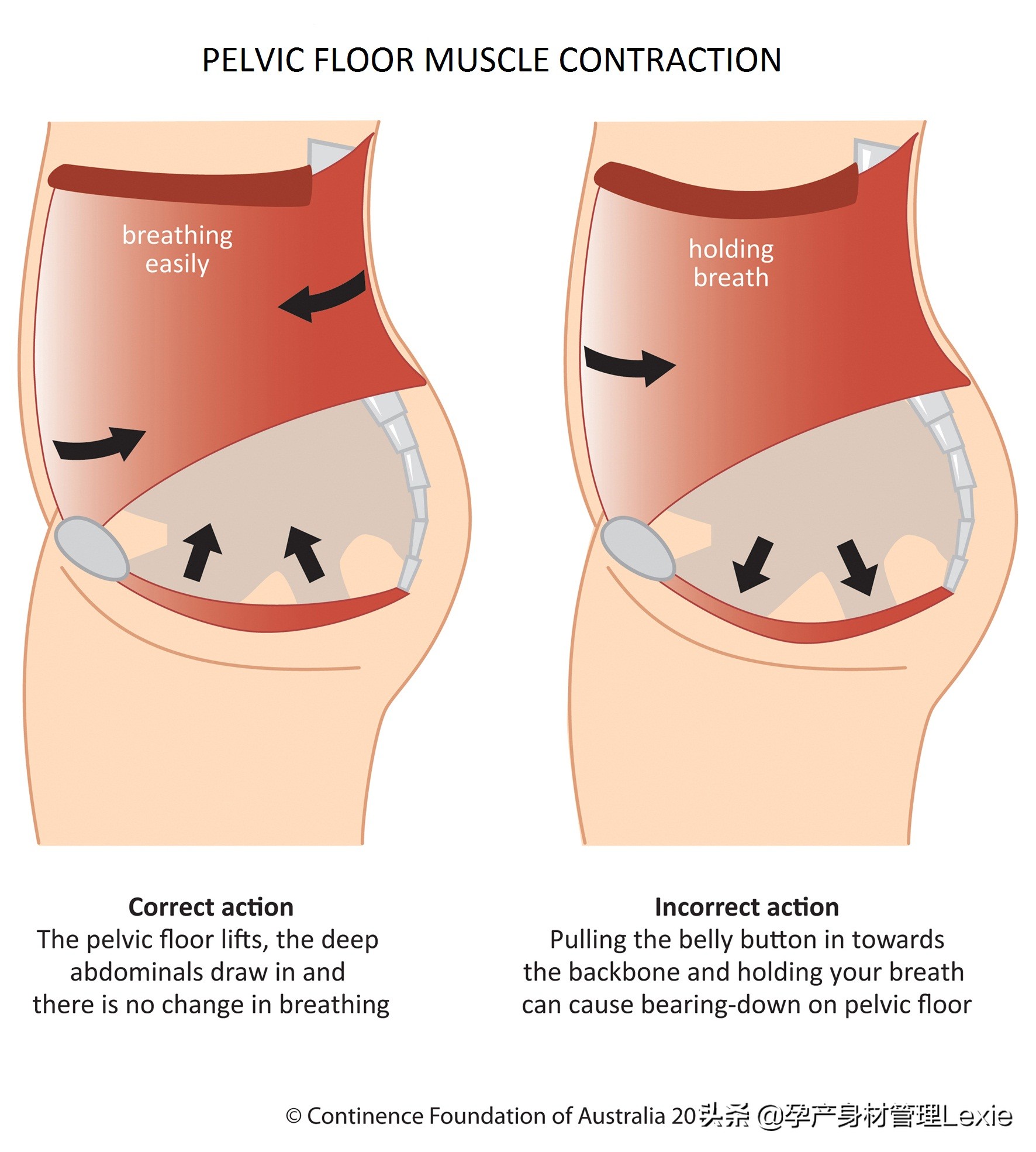 产后盆骨肌训练视频,孕妇骨盆底肌训练方法