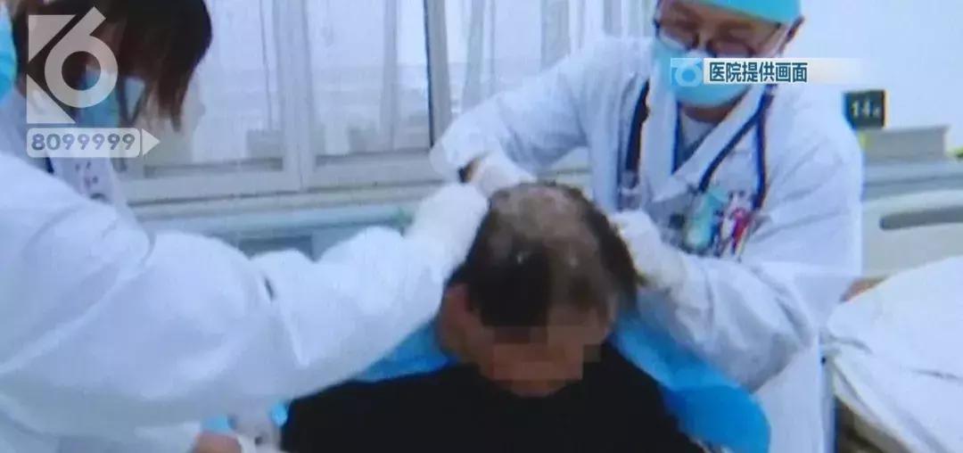 大哥敌敌畏洗头,敌敌畏洗头以毒攻毒的视频