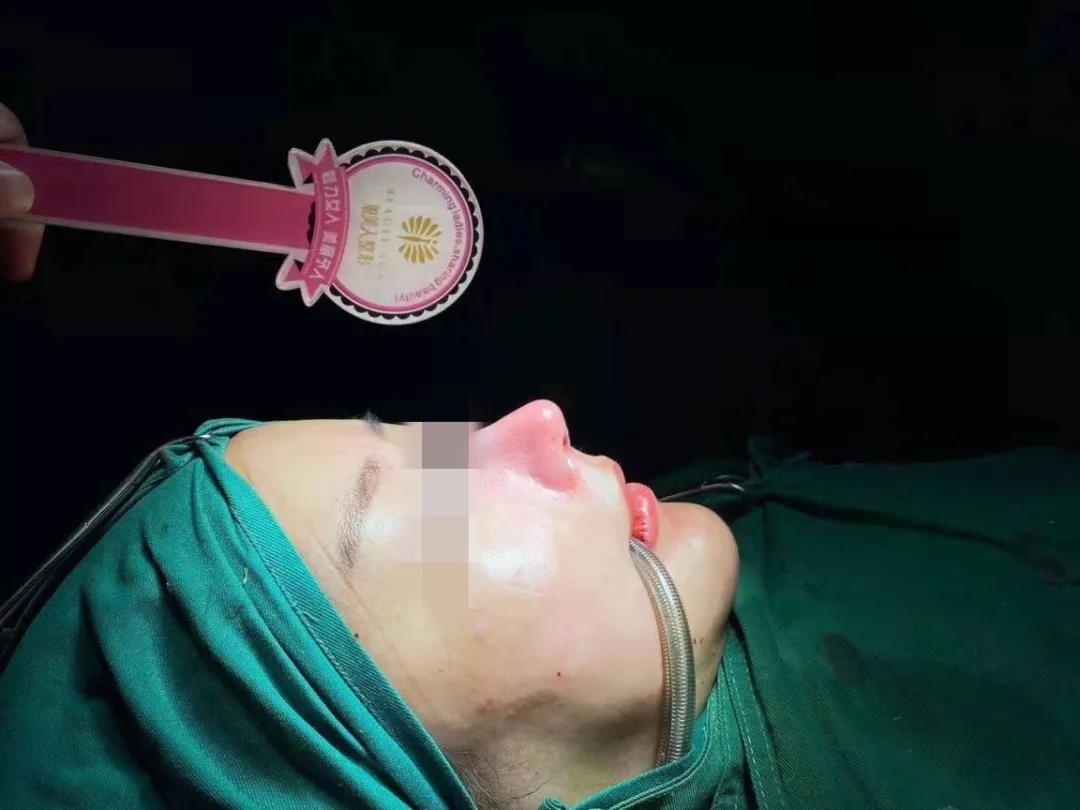 流浓鼻涕还散发臭味！昆明一女子整容后发现鼻腔内留有异物：无法见人...