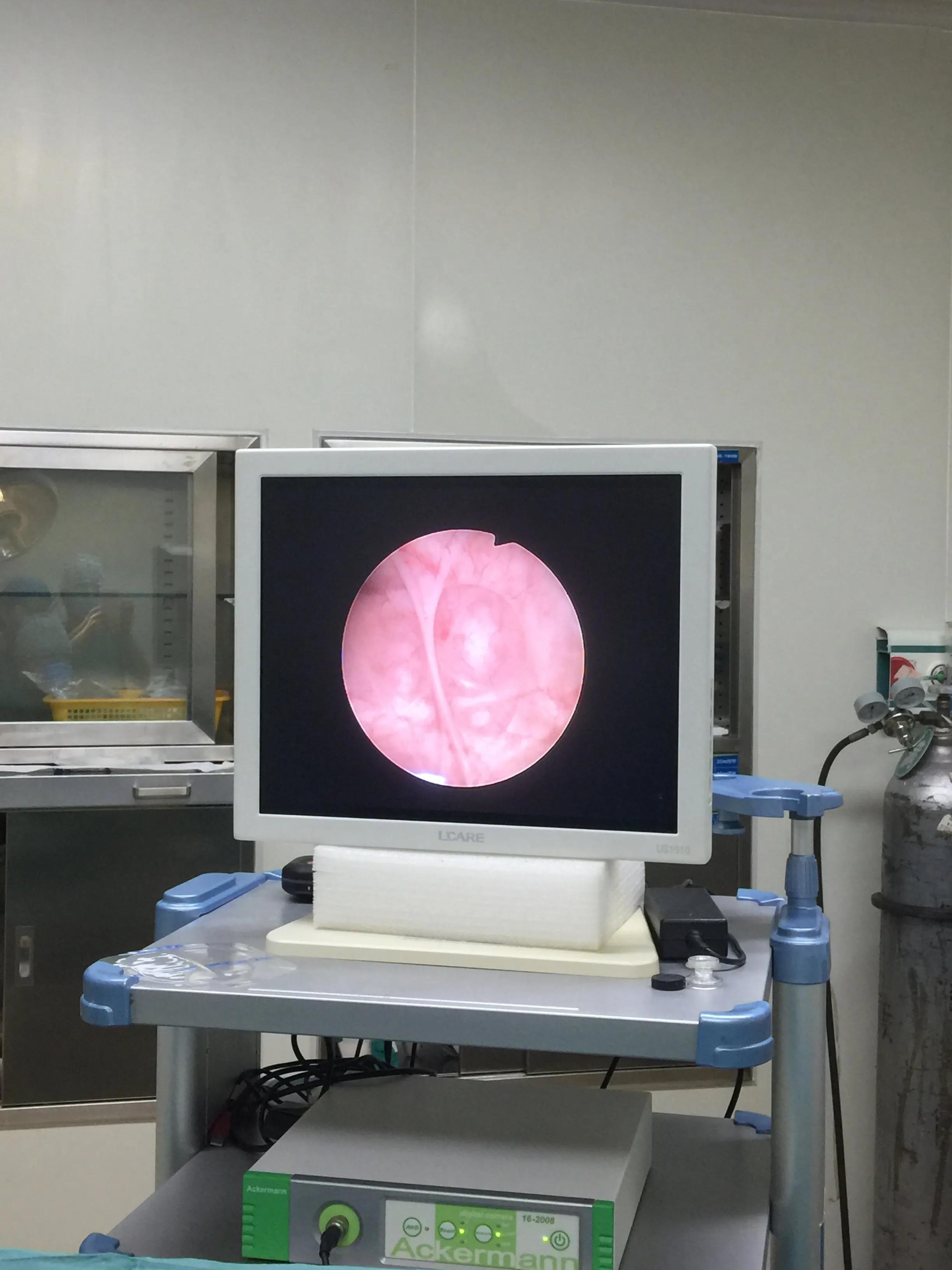 女病人尿不出怎么办,女病人排不出尿最快方法