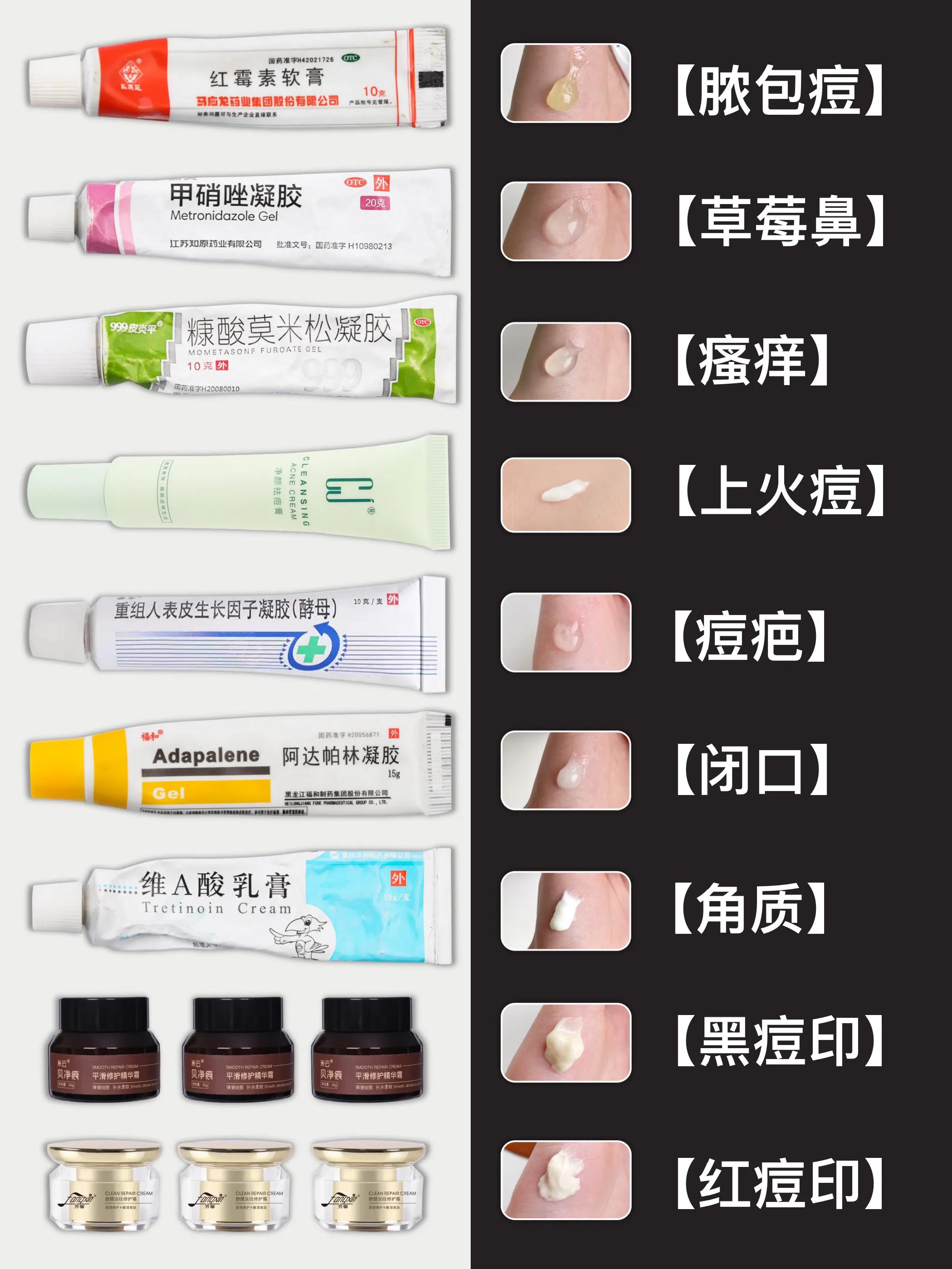 如何有效祛痘印痘疤,如何有效祛痘印的方法