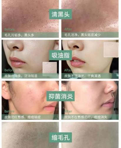 火山泥真是宝，油皮女孩的毛孔疏通剂，让贵妇霜3秒吃透锁水8倍