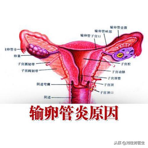 坚持这6点，输卵管问题离你越来越远，附输卵管炎用药