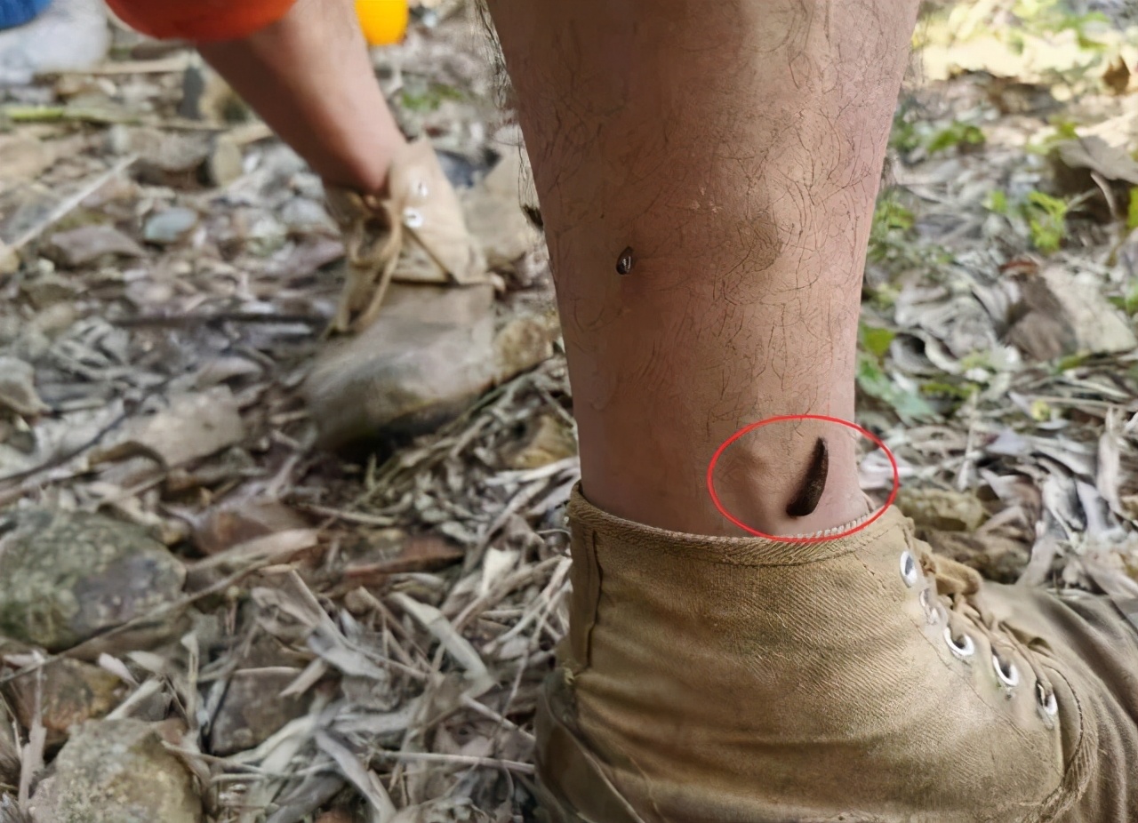 被水蛭咬了后怎么弄出来,水蛭被人吃进肚子里它能活多久