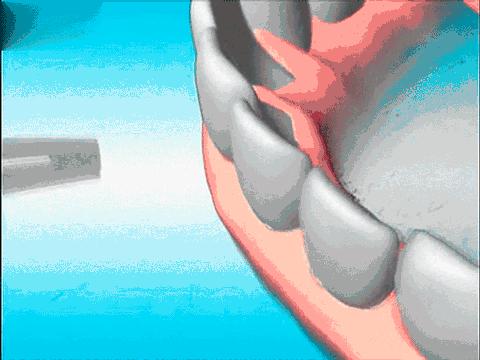 男子患梅毒20年没治疗,男子体检查出梅毒原因让人震惊了